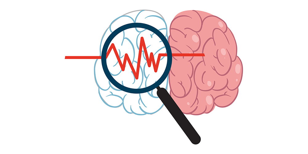Classification and work-up of ischemic stroke patients A stroke classification based on etiopathogenesis
