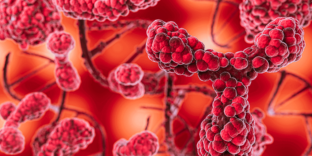 Differential diagnosis of vasculitis